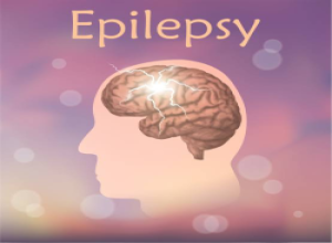 MYTHS AND FACTS ABOUT EPILEPSY