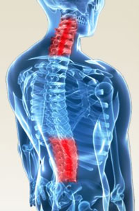 Spinal--Problem